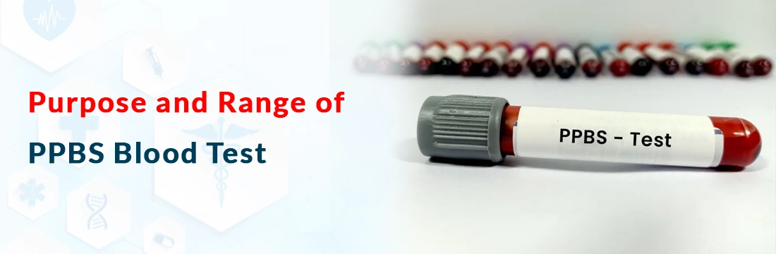 Purpose and Range of PPBS Blood Test